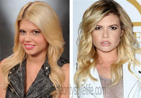 chanel west coast plastic surgery|Chanel West Coast's Transformation: The Truth Behind Plastic .